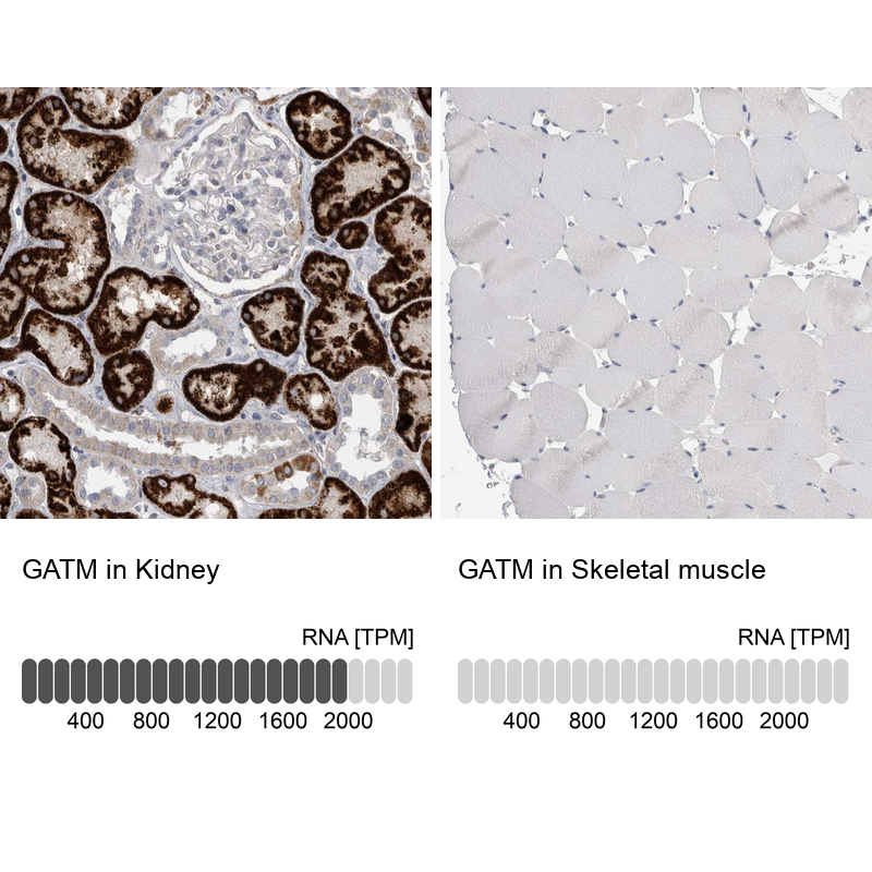 Anti-GATM Antibody