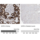 Anti-GATM Antibody