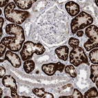 Immunohistochemical staining of human kidney shows moderate to strong cytoplasmic positivity in cells in tubules.
