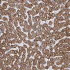 Immunohistochemical staining of human liver shows moderate to strong cytoplasmic positivity in hepatocytes.