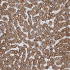 Immunohistochemical staining of human liver shows moderate to strong cytoplasmic positivity in hepatocytes.