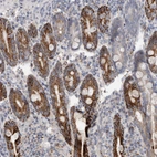 Immunohistochemical staining of human duodenum shows moderate to strong cytoplasmic positivity in glandular cells.