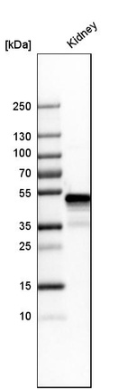 Western blot analysis in human kidney tissue.