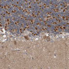 Immunohistochemical staining of human cerebellum shows moderate to strong cytoplasmic positivity in a subset of cells cells in granular layer.