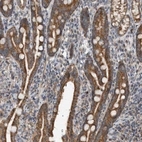 Immunohistochemical staining of human duodenum shows strong cytoplasmic positivity in glandular cells.
