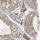 Immunohistochemical staining of human testis shows strong cytoplasmic positivity in Leydig cells.