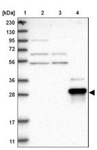 Lane 1: Marker [kDa] 230, 130, 95, 72, 56, 36, 28, 17, 11_br/_Lane 2: Human cell line RT-4_br/_Lane 3: Human cell line U-251MG sp_br/_Lane 4: Human plasma (IgG/HSA depleted)