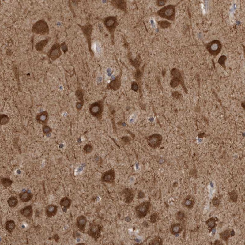 Anti-GPR61 Antibody