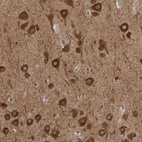 Anti-GPR61 Antibody