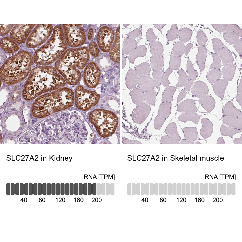 Anti-SLC27A2 Antibody
