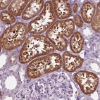 Immunohistochemical staining of human kidney shows strong granular cytoplasmic positivity in cells in tubules.