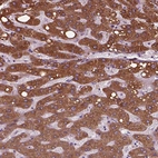 Immunohistochemical staining of human liver shows strong granular cytoplasmic positivity in hepatocytes.