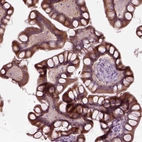Immunohistochemical staining of human small intestine shows moderate granular cytoplasmic positivity in glandular cells.