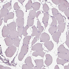 Immunohistochemical staining of human skeletal muscle shows no positivity in myocytes as expected.
