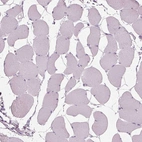 Immunohistochemical staining of human skeletal muscle shows no positivity in myocytes as expected.