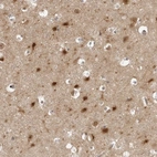 Anti-PTK2B Antibody