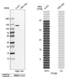 Western blot analysis in human cell lines A-431 and HEK293 using Anti-PTK2B antibody. Corresponding PTK2B RNA-seq data are presented for the same cell lines. Loading control: Anti-GAPDH.