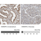 Anti-HNRNPR Antibody