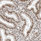 Immunohistochemical staining of human endometrium shows high expression.