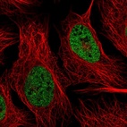 Immunofluorescent staining of human cell line U-2 OS shows localization to nucleoplasm.