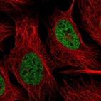 Immunofluorescent staining of human cell line U-2 OS shows localization to nucleoplasm.