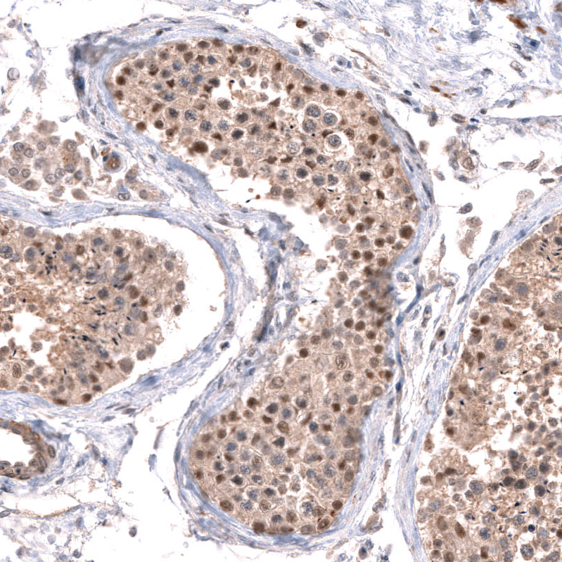 Anti-C7orf72 Antibody