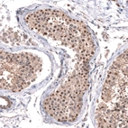 Anti-C7orf72 Antibody