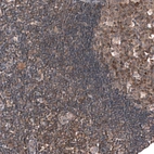 Immunohistochemical staining of human lymph node shows moderate cytoplasmic positivity in non-germinal- and germinal center cells.