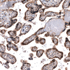 Immunohistochemical staining of human placenta shows moderate cytoplasmic and nuclear positivity in trophoblastic cells.