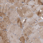 Immunohistochemical staining of human skeletal muscle shows moderate cytoplasmic positivity in myocytes.