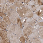 Immunohistochemical staining of human skeletal muscle shows moderate cytoplasmic positivity in myocytes.