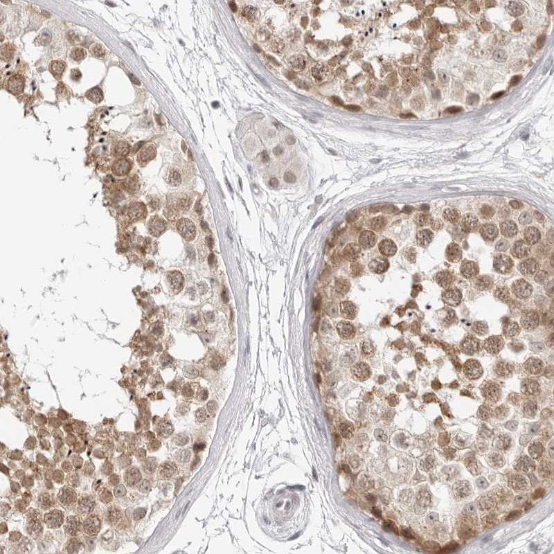 Anti-C8orf48 Antibody