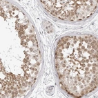 Anti-C8orf48 Antibody
