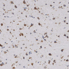 Anti-AKAP9 Antibody