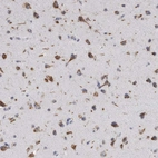 Immunohistochemical staining of human cerebral cortex shows moderate granular positivity in cytoplasm granular in neurons.