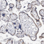Immunohistochemical staining of human placenta shows moderate granular positivity in cytoplasm in trophoblastic cells.