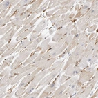 Immunohistochemical staining of human heart muscle shows strong cytoplasmic positivity in cardiomyocytes.