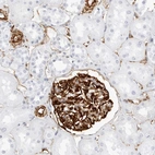 Immunohistochemical staining of human kidney shows strong cytoplasmic positivity in cells in glomeruli.