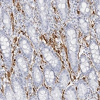 Immunohistochemical staining of human duodenum shows strong cytoplasmic positivity in endothelial cells.