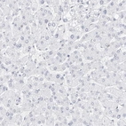Immunohistochemical staining of human liver shows negative cytoplasmic positivity in hepatocytes as expected.