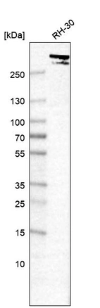 Western blot analysis in human cell line RH-30.
