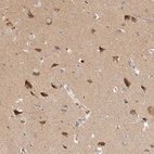 Immunohistochemical staining of human cerebral cortex shows high expression.