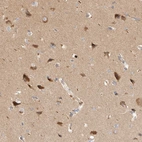 Immunohistochemical staining of human cerebral cortex shows high expression.
