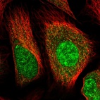 Immunofluorescent staining of human cell line U-2 OS shows localization to nucleoplasm & cytosol.