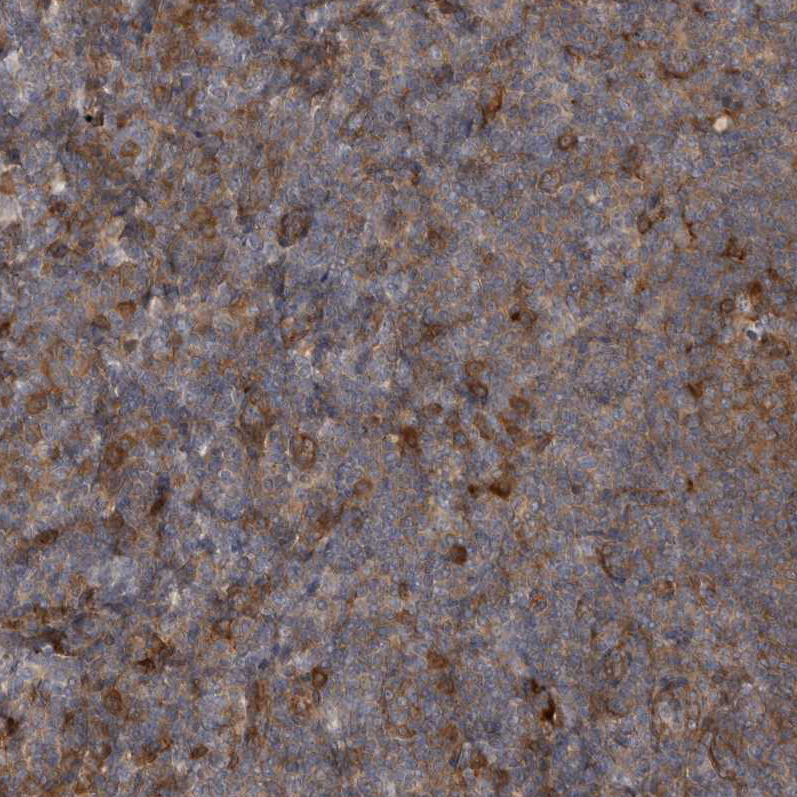Anti-RAB3GAP2 Antibody