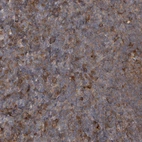 Anti-RAB3GAP2 Antibody