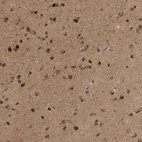 Immunohistochemical staining of human cerebral cortex shows moderate positivity in neuropil.
