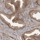 Immunohistochemical staining of human prostate shows moderate cytoplasmic positivity in glandular cells.
