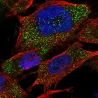 Immunofluorescent staining of human cell line U-251 MG shows localization to cytosol.