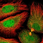 Anti-DNAJC8 Antibody